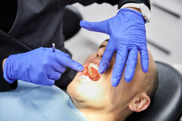 Best Chipped Tooth Repair Near Me  in Neodesha, KS