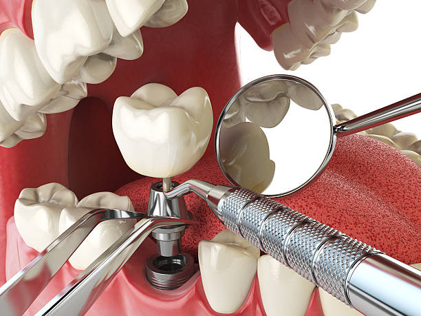 Best Emergency Gum Pain Relief  in Neodesha, KS